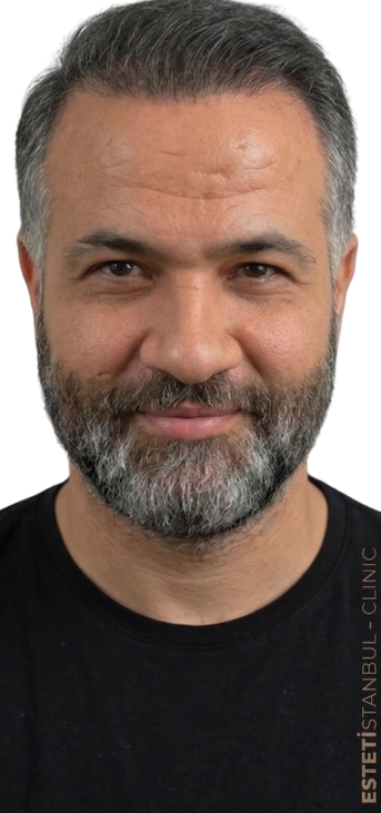 Roman H. after