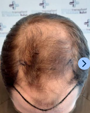 Luigi L. Before