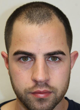 Anthony G. Before